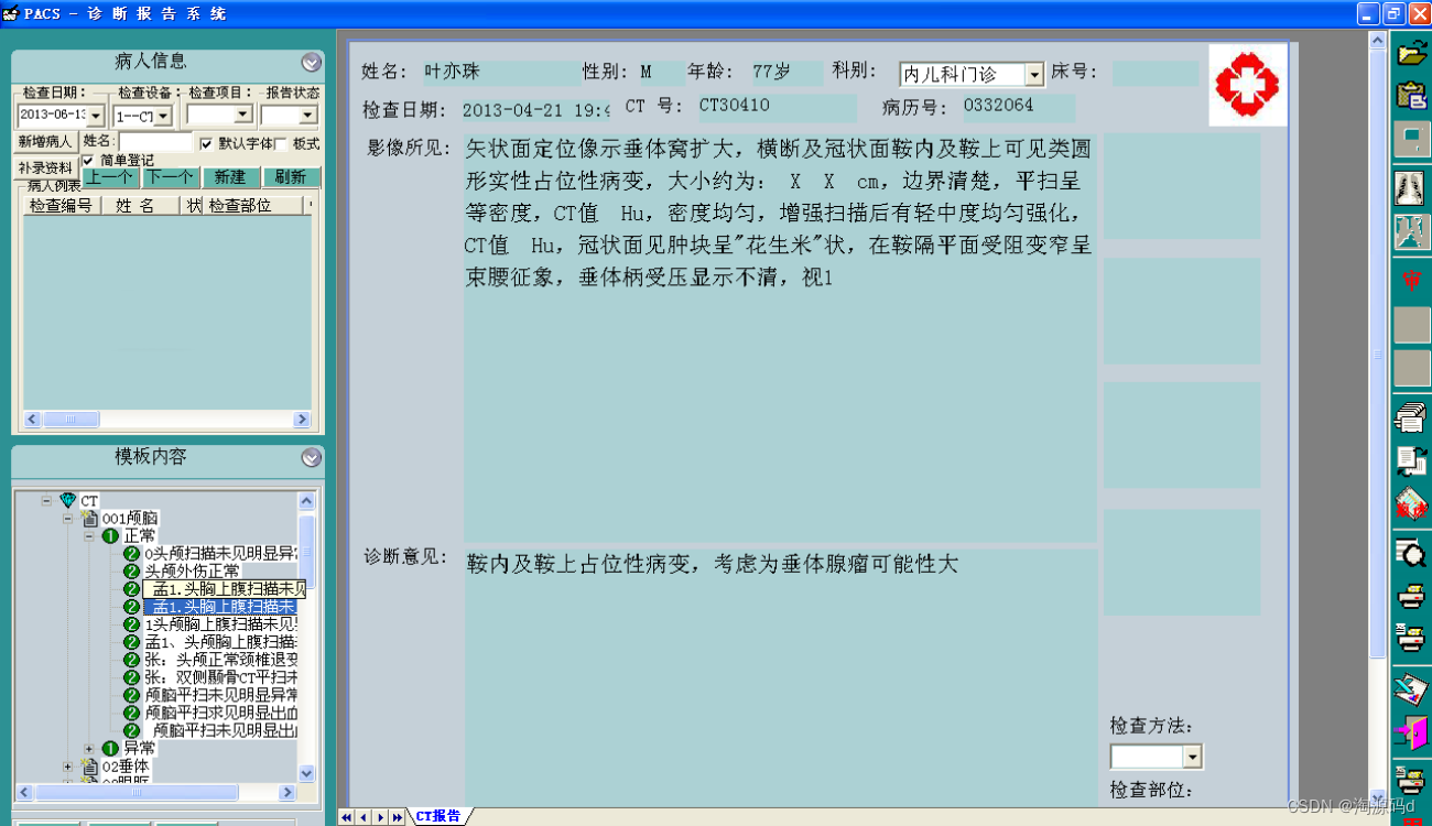 PACS/RIS系统源码 支持专业三维影像后处理功能，支持海量数据存储、迁移管理