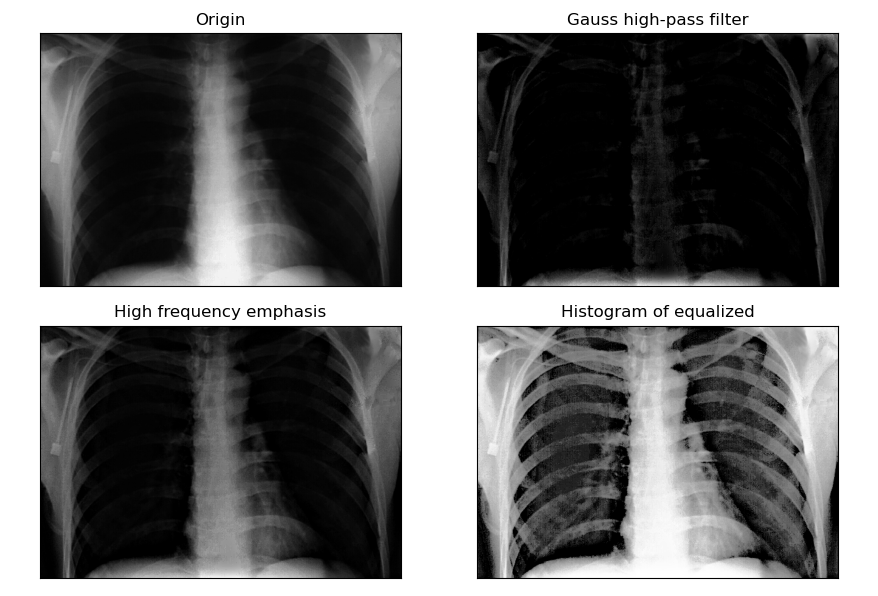 【OpenCV 例程200篇】87. 频率域钝化掩蔽