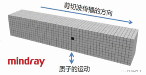 医用超声检查设备