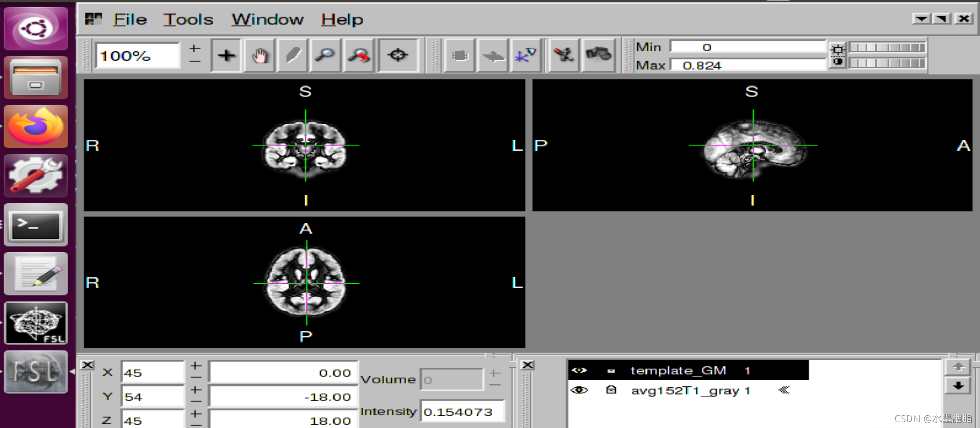 用FSL进行VBM统计分析