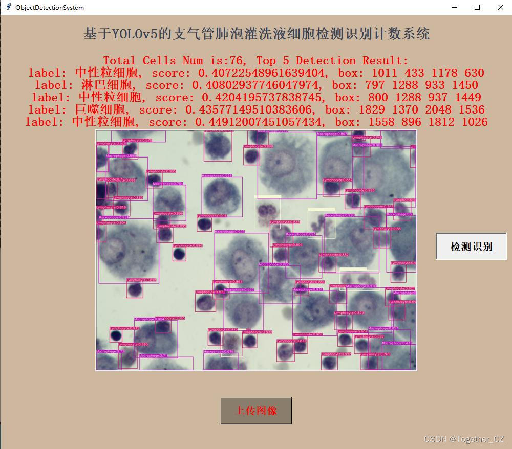 助力智能医疗检测计数，基于yolov5开发构建支气管肺泡灌洗液细胞检测识别计数系统