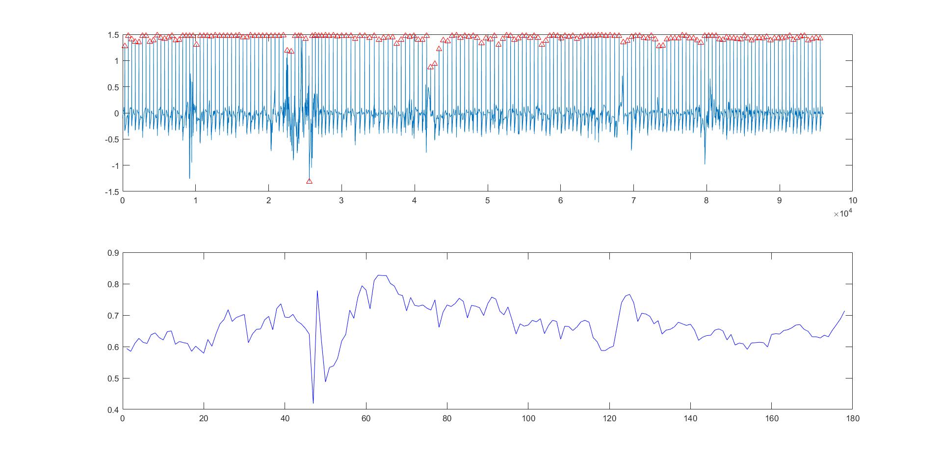 MATLAB implementation for Forstner feature extraction Programmer Sought