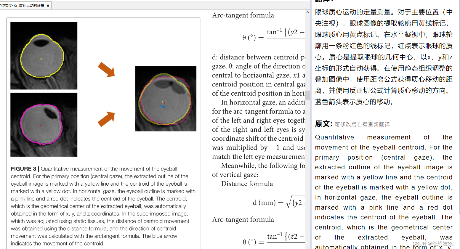 Positional Change of the Eyeball During Eye Movements: Evidence of 