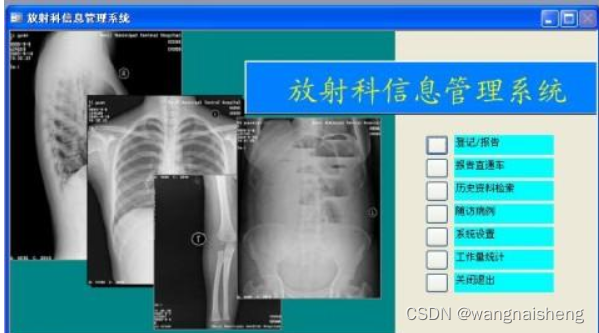 医院常见的HIS、CIS、LIS、EMR、PACS、RIS医疗信息化中的介绍