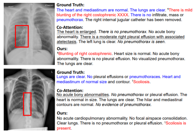 Competence Based Multimodal Curriculum Learning For Medical Report Generation Acl 21 解读 总结 Johngo学长