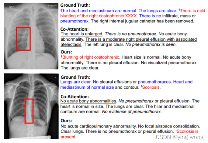 Competence Based Multimodal Curriculum Learning For Medical Report Generation Acl 21 解读 总结 Johngo学长