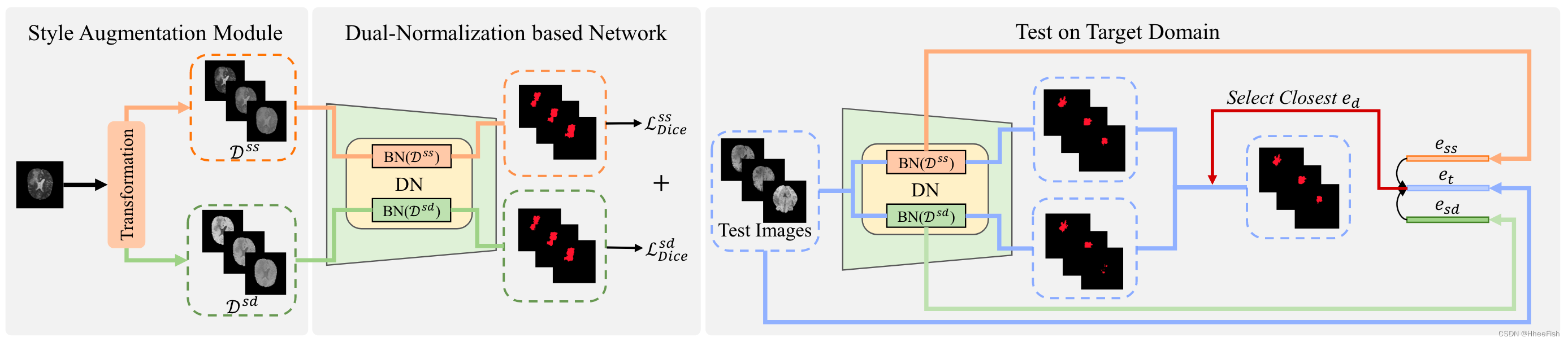 CVPR2022:Generalizable Cross-modality Medical Image Segmentation via StyleAugmentation and Dual Norm