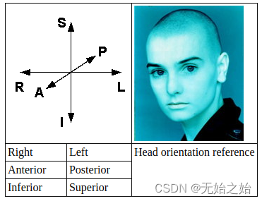 Orientation and Voxel-Order Terminology: RAS, LAS, LPI, RPI, XYZ and All That