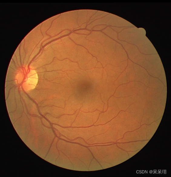 UNET-RKNN分割眼底血管