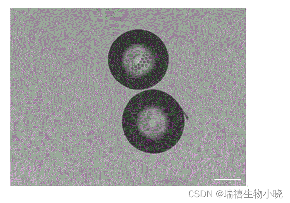 壳聚糖基原位水凝胶包载角膜缘干细胞/纳米壳聚糖骨形态发生蛋白水凝胶的研究制备