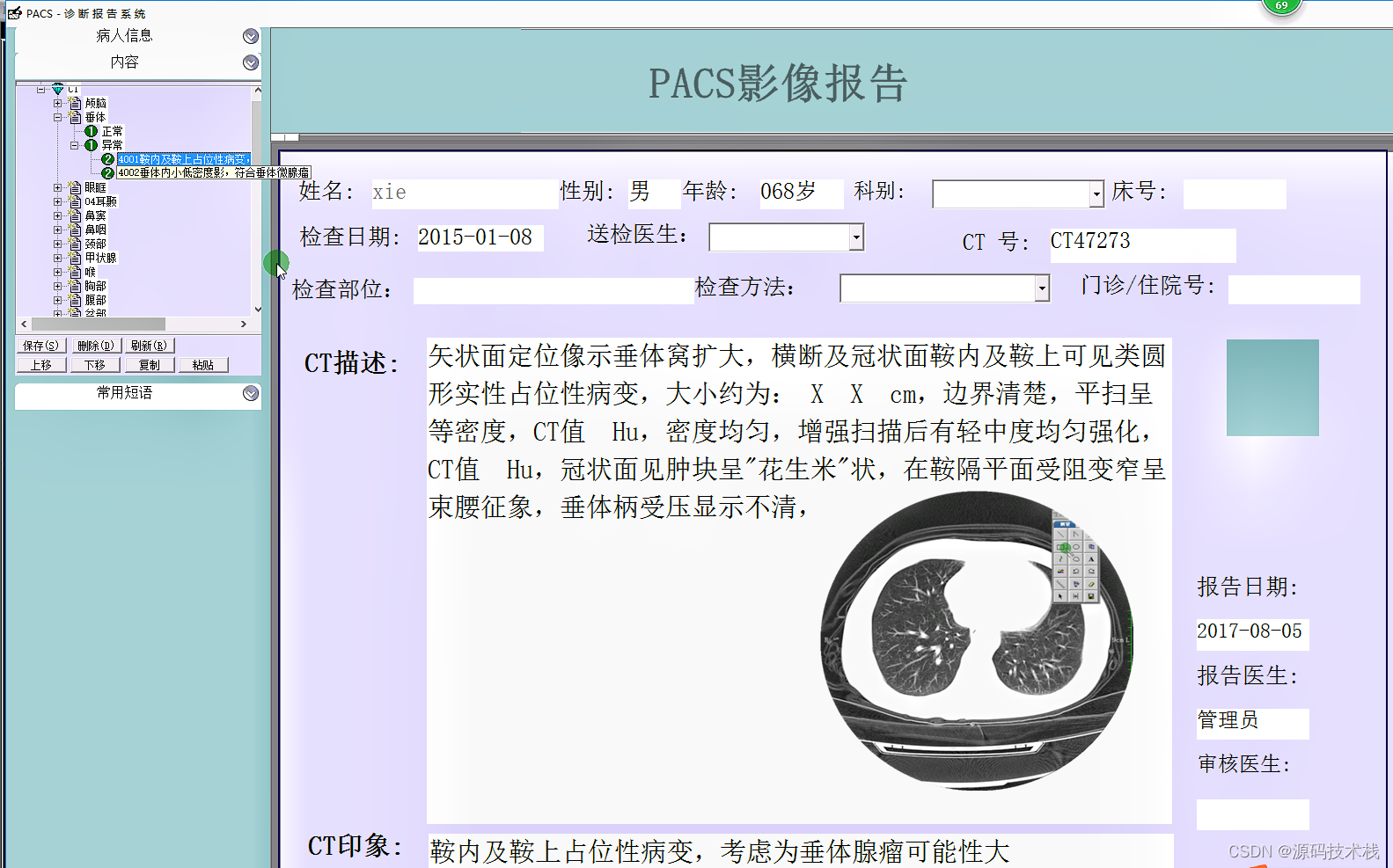 一套完整的三甲医院医学影像科PACS系统源码