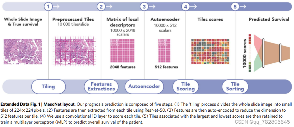 Deep learning-based classification of mesothelioma improves prediction of patient outcom