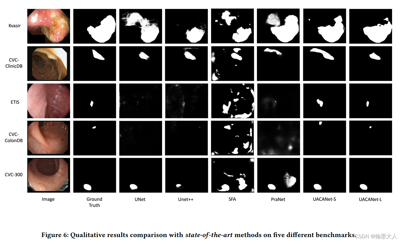 UACANet: Uncertainty Augmented Context Attention for Polyp Segmentation