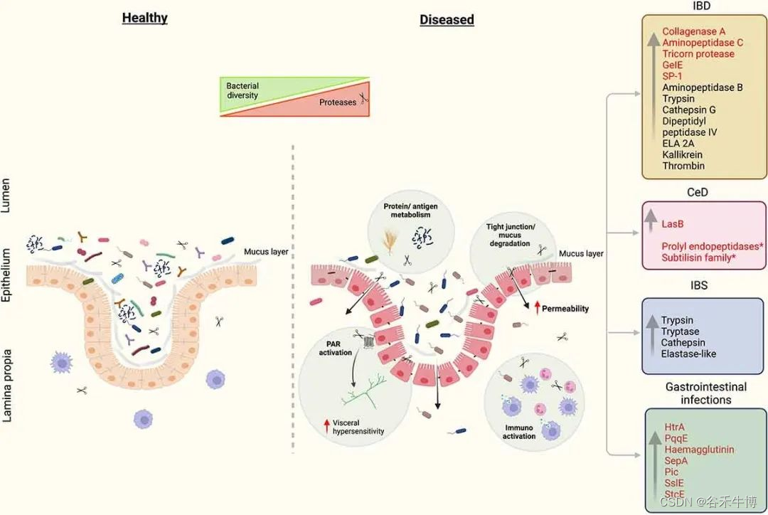消化道炎症 | 细菌蛋白酶失调的作用