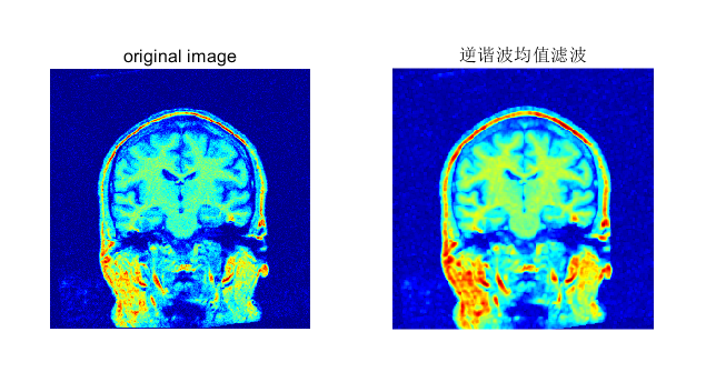 MATLAB逆谐波均值滤波