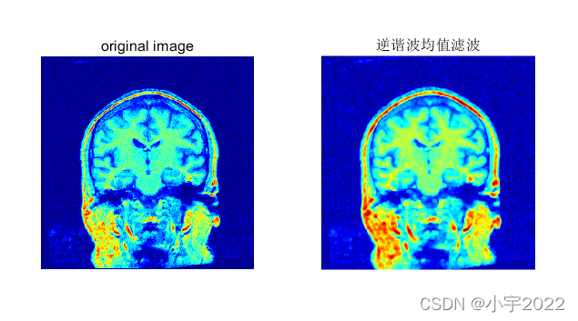 MATLAB逆谐波均值滤波