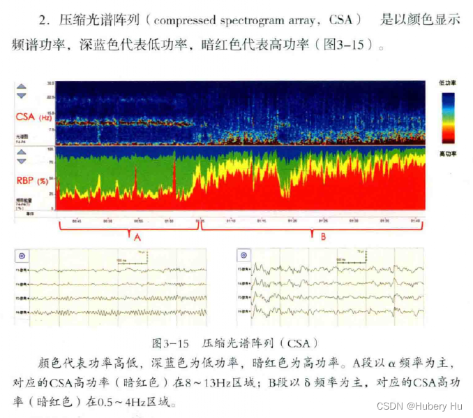 重症量化脑电-算法和特征篇_相对α变异-CSDN博客