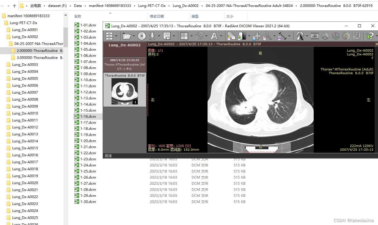 玩转肺癌目标检测数据集Lung-PET-CT-Dx ——①从TCIA获取影像数据集 - 站长快讯 - 主机测评