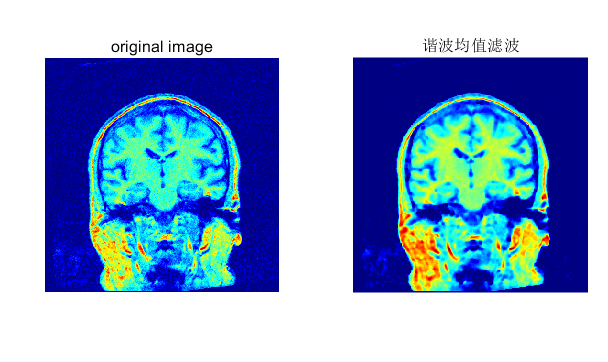 MATLAB谐波均值滤波