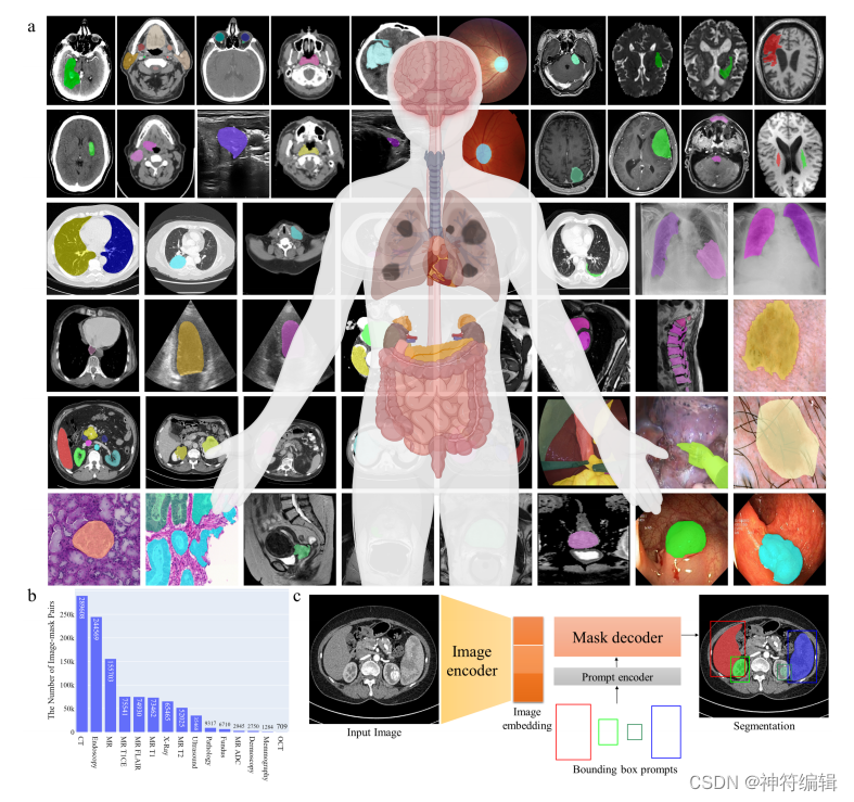 MedSAM通用医学分割基础模型（2023+Segment Anything in Medical Images）