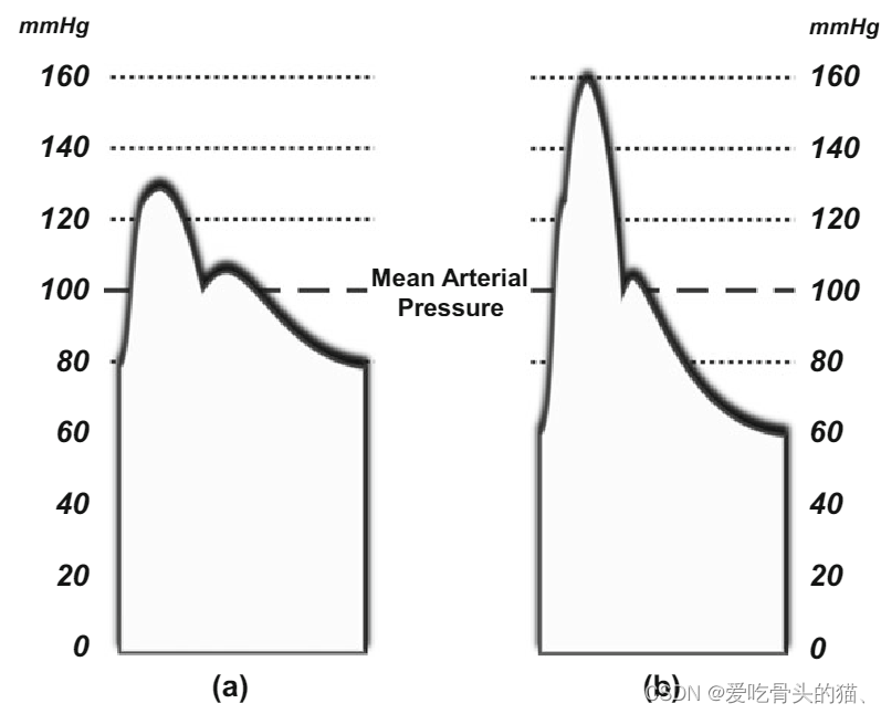 血流动力学与血压(一)--平均动脉压