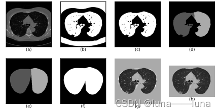 luna16-预处理至froc曲线完整过程(医学图像检测/分割3d通用方法)