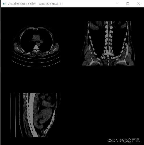 VTK CT重建（一） MPR 多层面重建 四视图