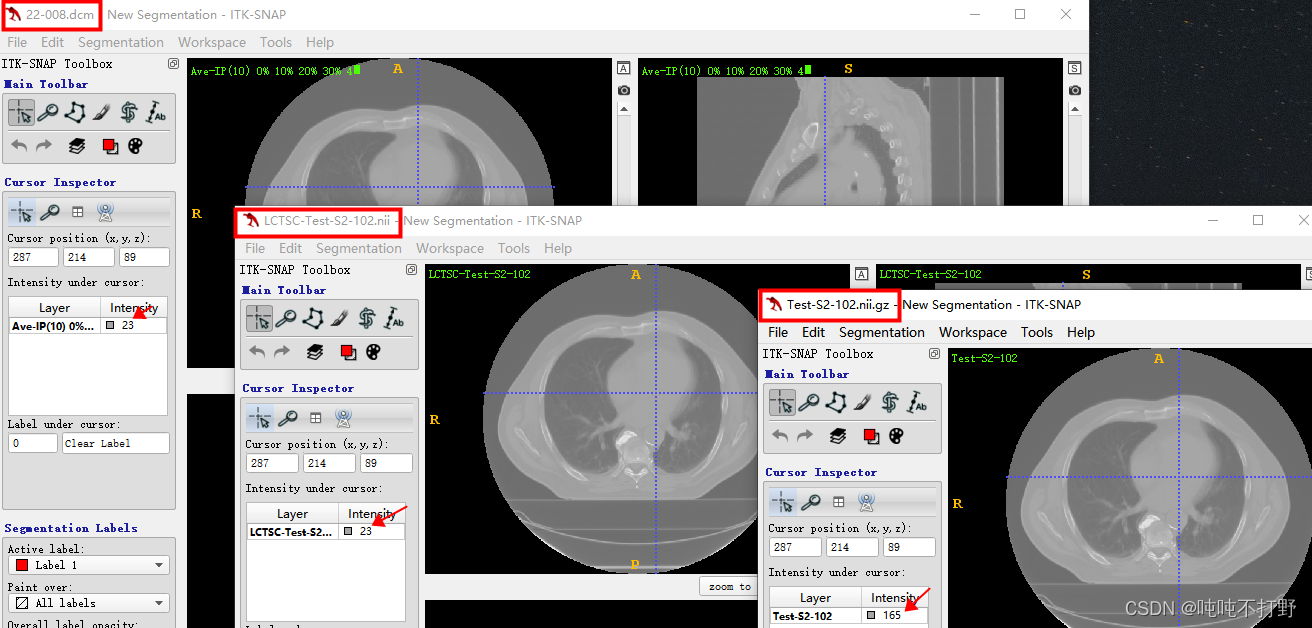 DICOM-RT struct在python中显示mask以及使用3d Slicer转换为nii_吨吨不打野的博客-CSDN博客