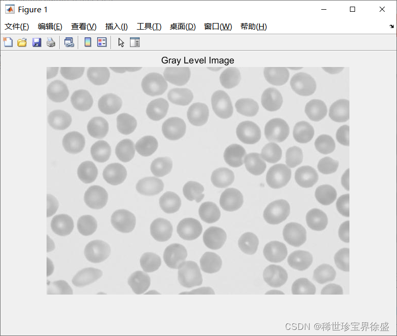 Matlab 练习:细胞计数(imfill&open&erosion的综合应用)_matlab细胞计数-CSDN博客