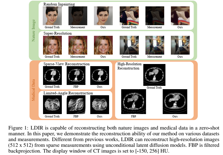 Iterative Reconstruction Based on Latent Diffusion Model for Sparse ...