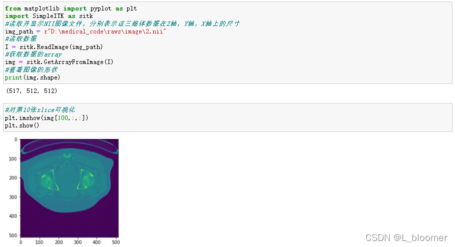 Nii File Python nii数据的各种处理详解_acdc数据集nii文件在pytorch中需要处理吗-CSDN博客