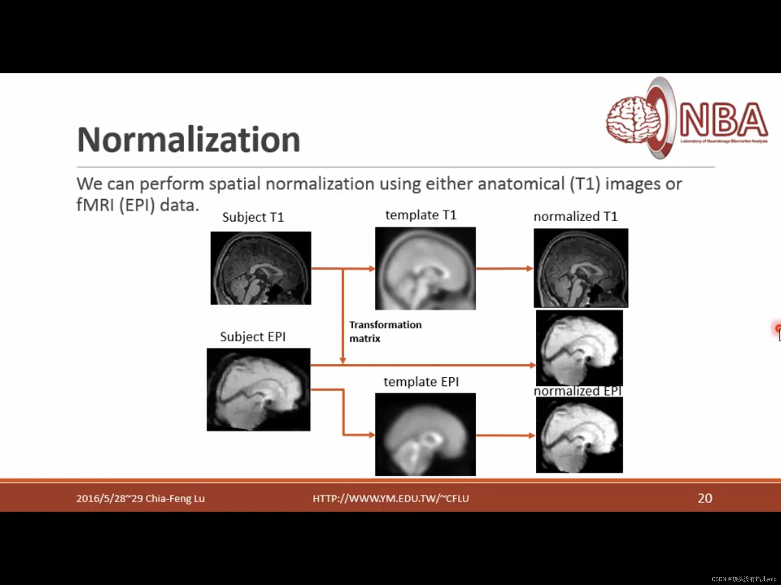 卢家峰课程系列-- advanced rs-fmri analysis 2/6 SPM预处理与batch_rsfmri240个vol怎么处理 ...
