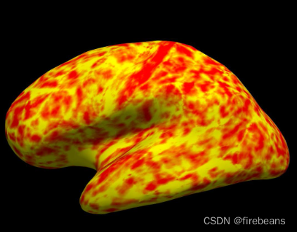 freesurfer入门-试图理解freesurfer输出的数据
