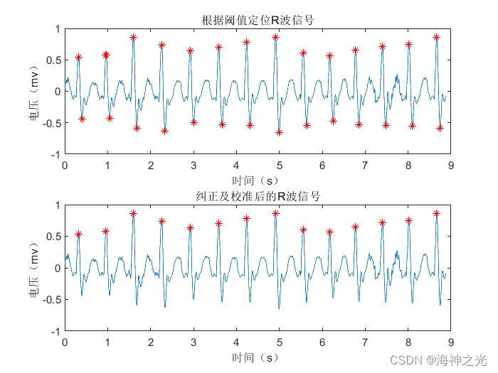 【心电信号】基于matlab心电信号QRS波检测【含Matlab源码 3404期】