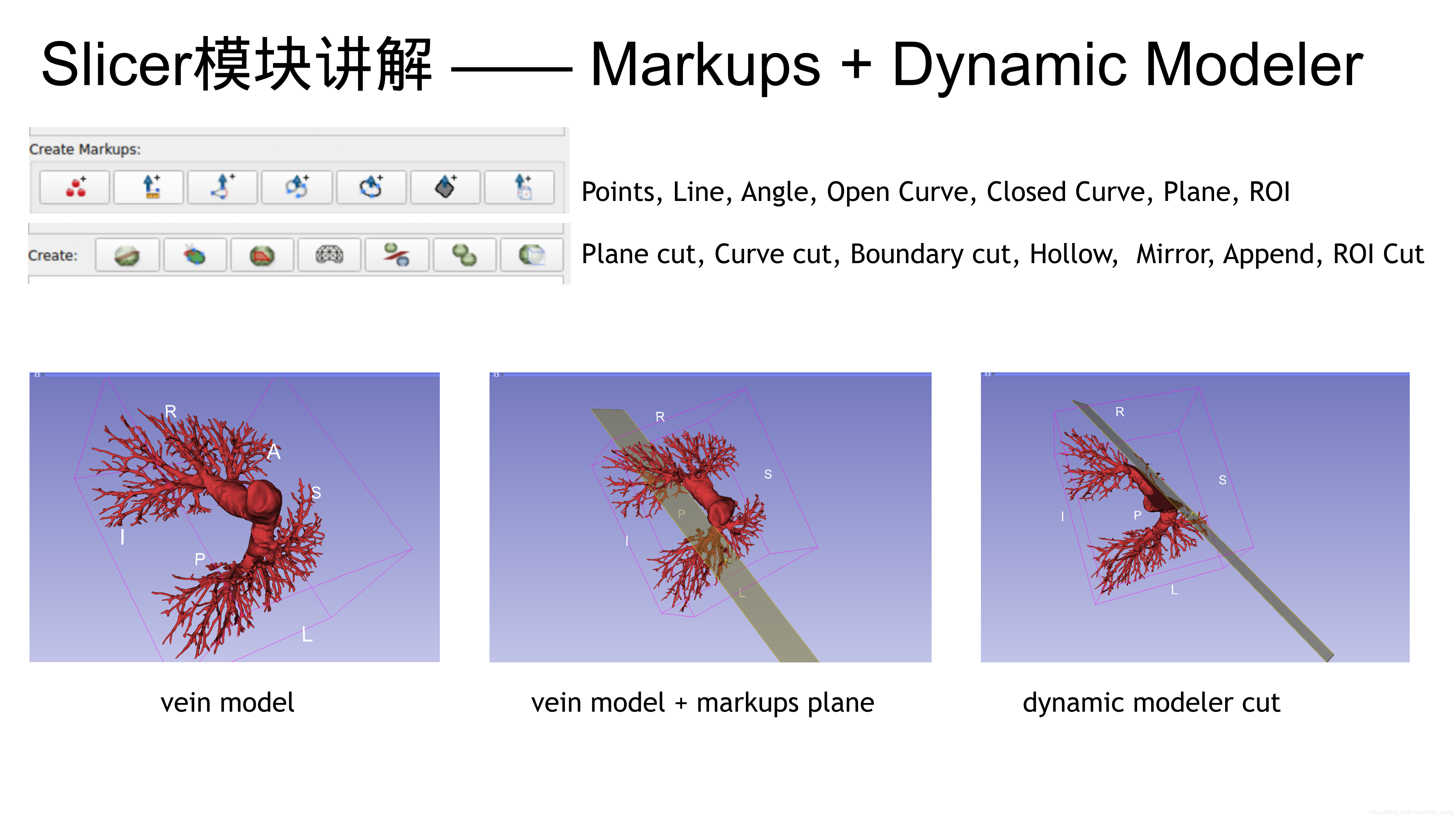 3d Slicer开发者入门_3d slicer 开发者模式-CSDN博客