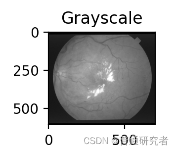 opencv-医学图像预处理