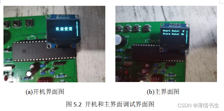 基于51单片机的脉搏测量仪设计与实现