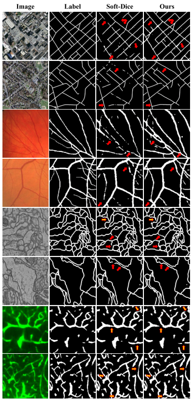 【论文阅读】clDice - a Novel Topology-Preserving Loss Function for Tubular Structure Segmentation