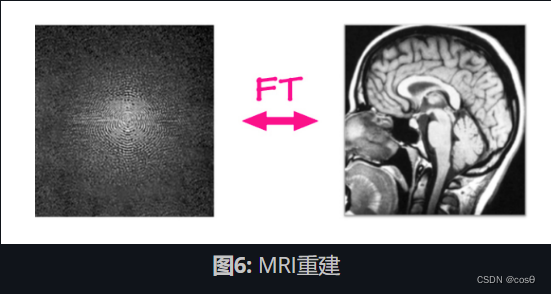图6: MRI重建