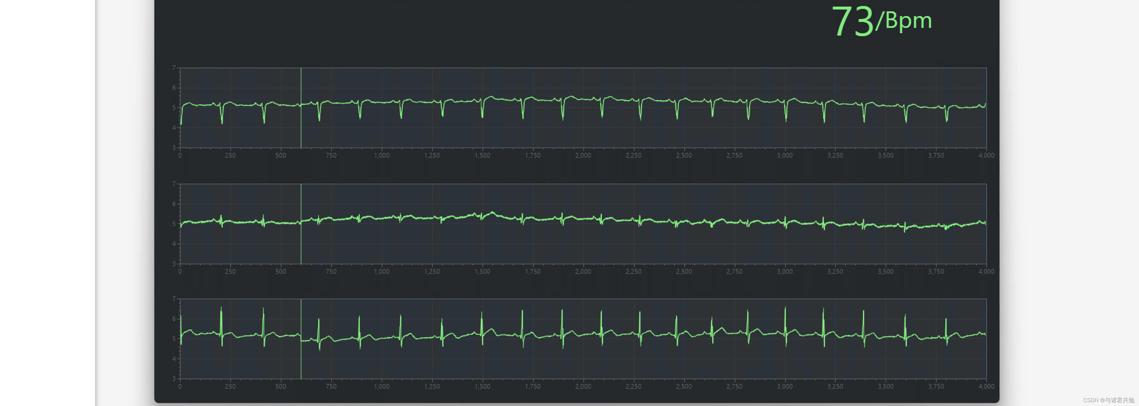 avalonia、WPF使用ScottPlot动态显示ECG心电图