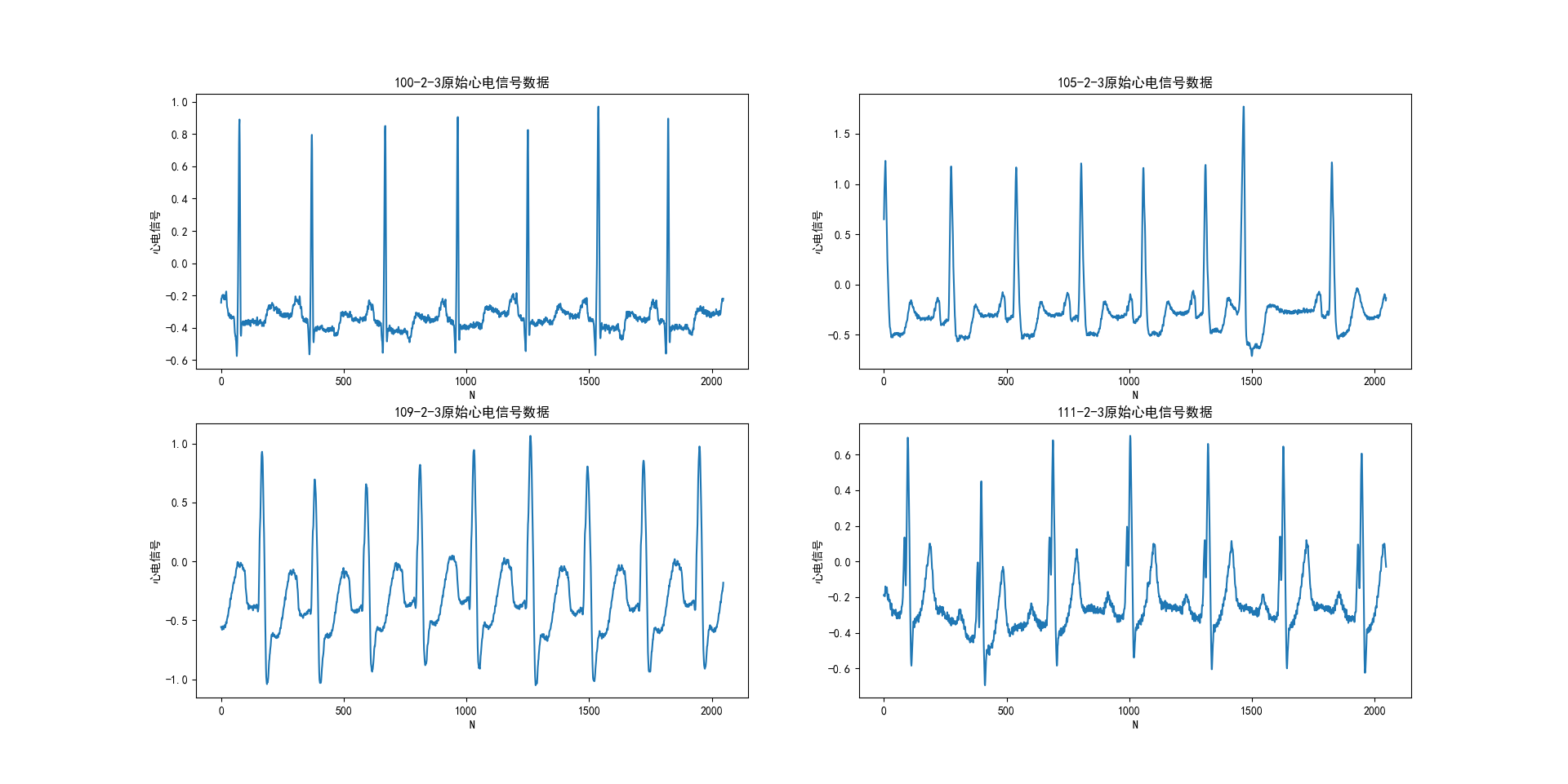 基于Python的心电信号检测与处理_python 检测r波位置-CSDN博客