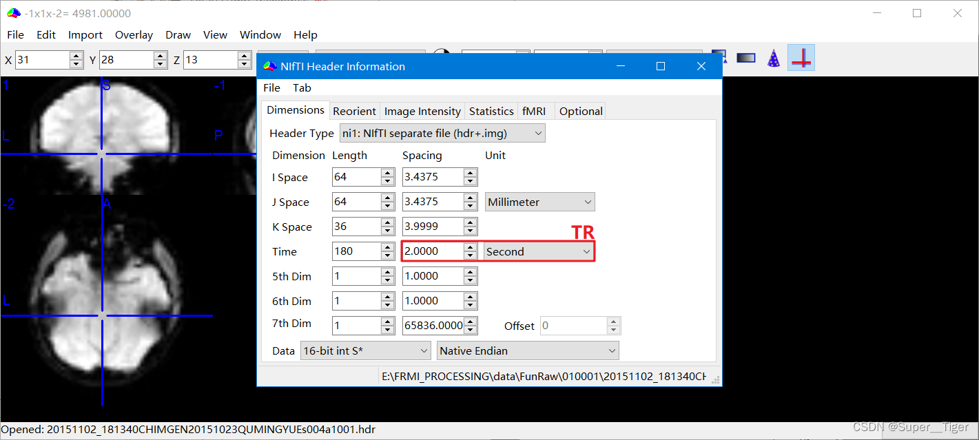 医学影像静息态fmri数据的预处理
