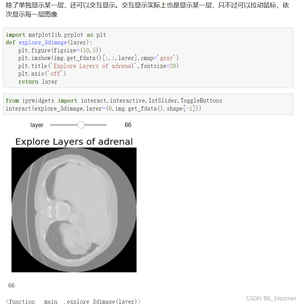 Nii File Python nii数据的各种处理详解_acdc数据集nii文件在pytorch中需要处理吗-CSDN博客