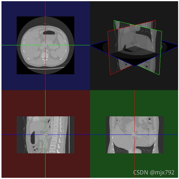 Vtk Ct VTK显示CT图像视图_ct 数据 vtk 显示-CSDN博客