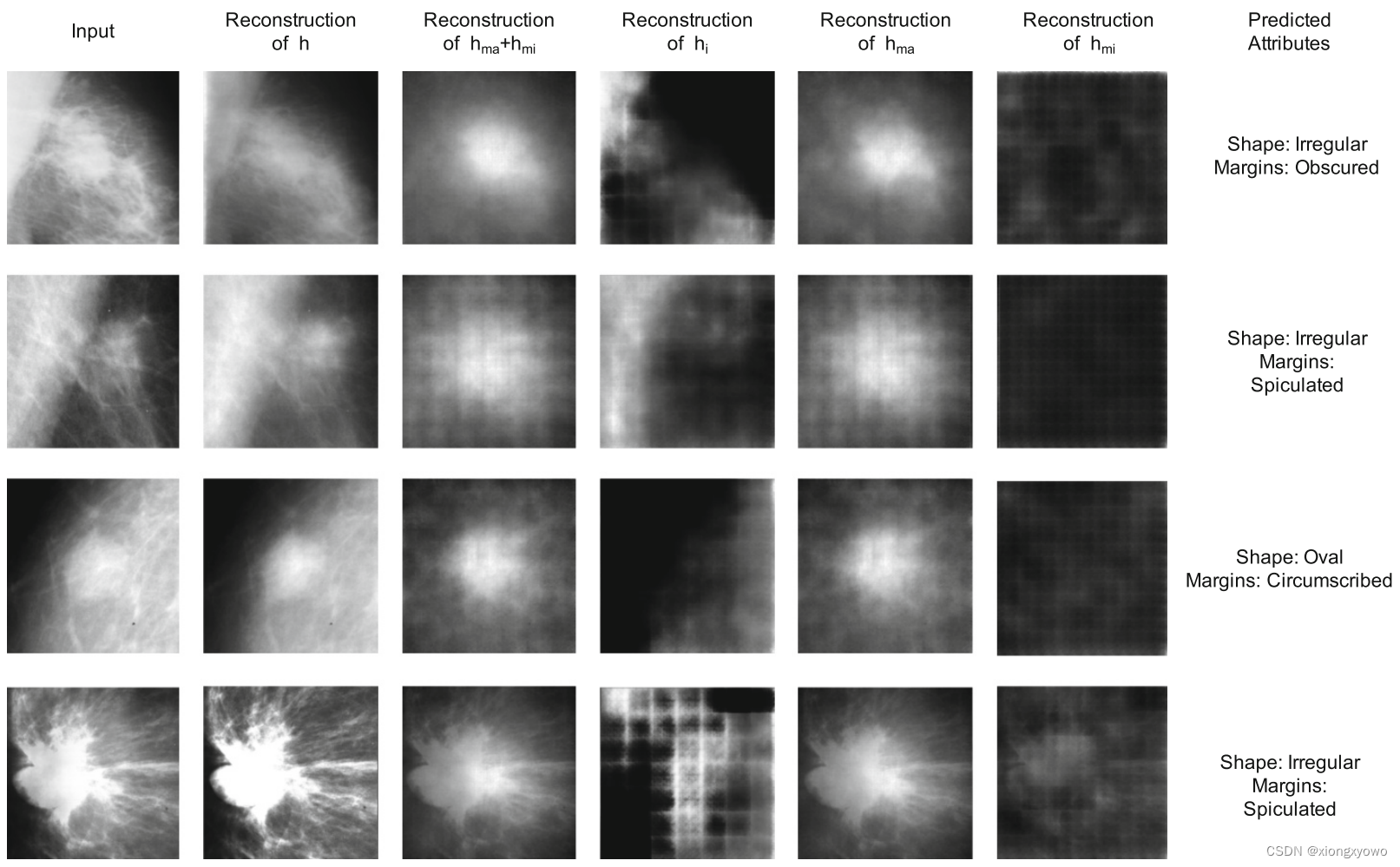 [论文阅读] DAE-GCN: Identifying Disease-Related Features for Disease Prediction