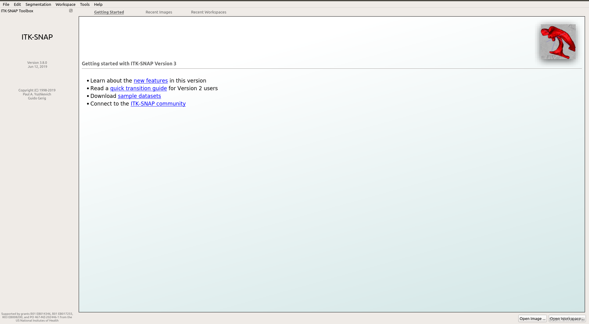 Linux系统安装使用ITKSNAP_linux安装itk snapCSDN博客