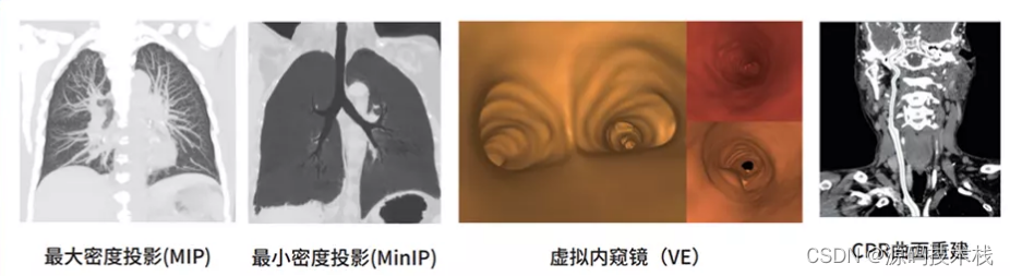 医学影像信息(PACS)系统软件源码