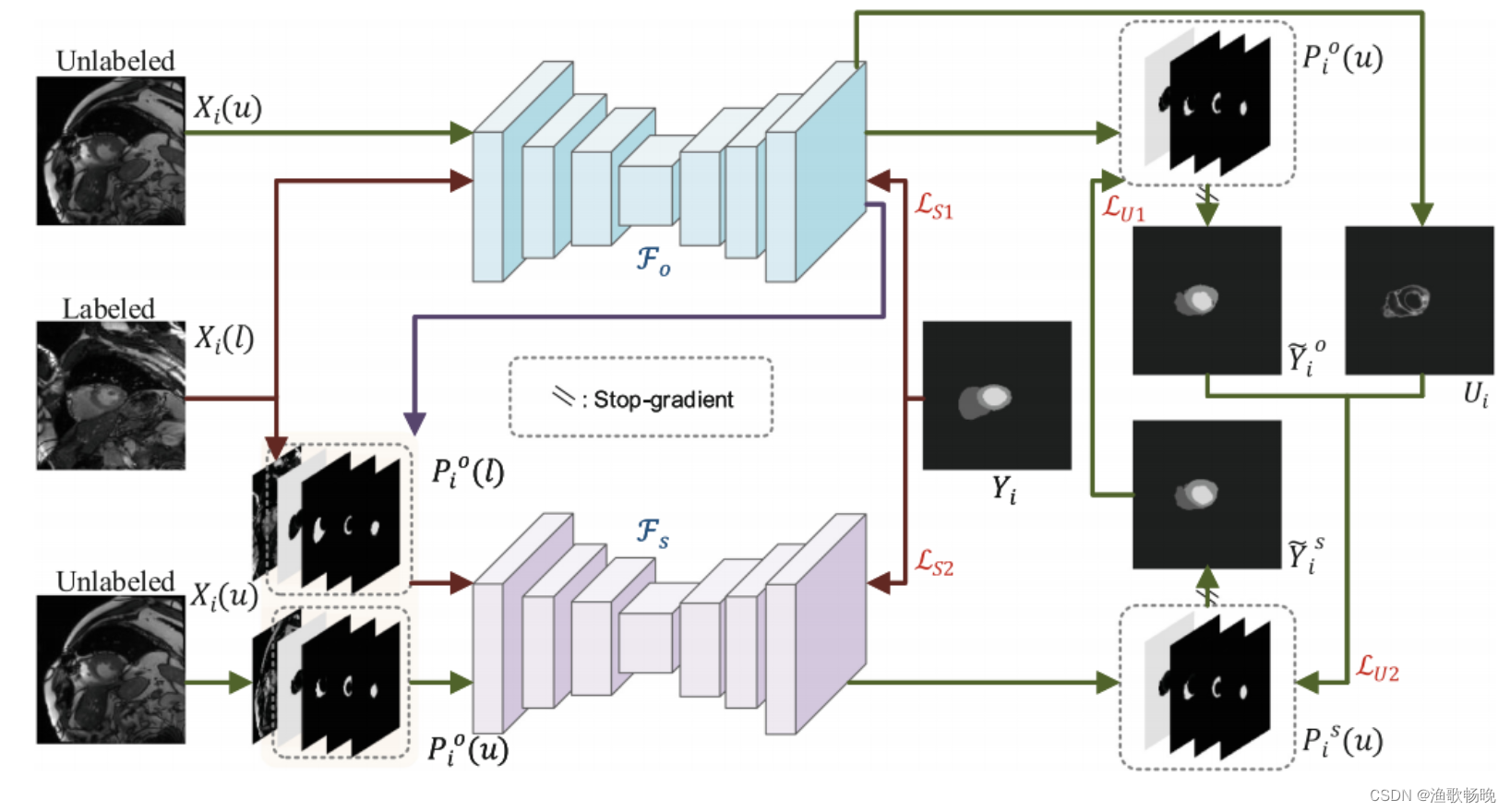 《Semi-supervised Medical Image Segmentation Using Cross-Model Pseudo ...