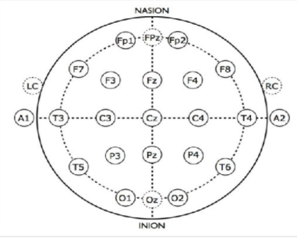 腦電圖電極位置國際標準1020