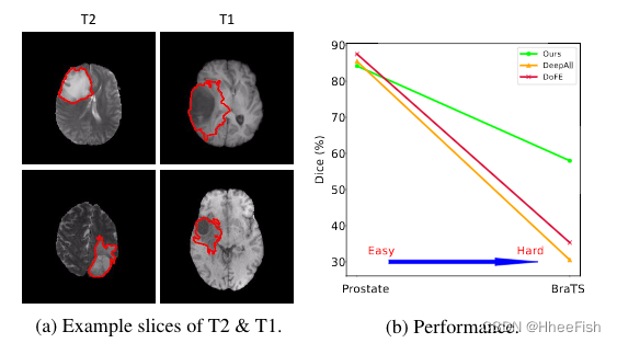 CVPR2022:Generalizable Cross-modality Medical Image Segmentation via StyleAugmentation and Dual Norm